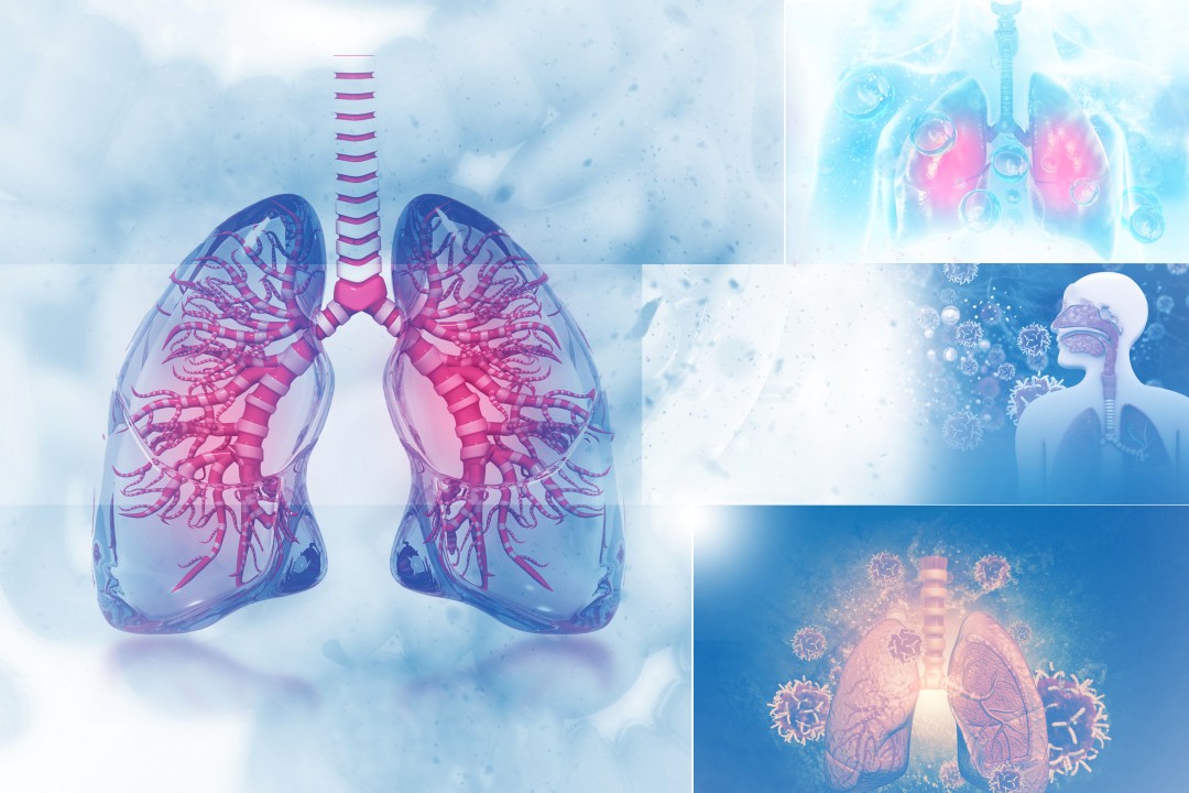 Lungs Disorders and Four Best Herbs to Make Your Lungs Healthy
