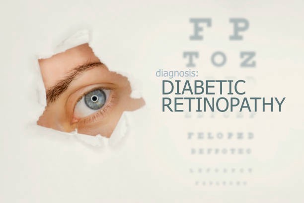 Artificial Intelligence Detects Diabetic Retinopathy in Real–Time