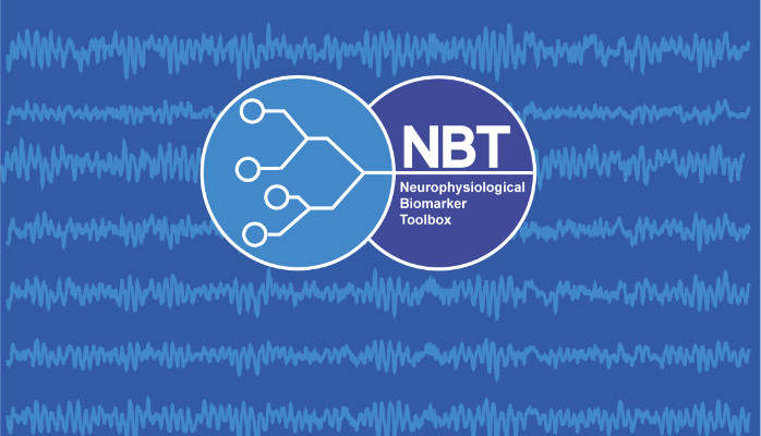 New NBT release, new versions