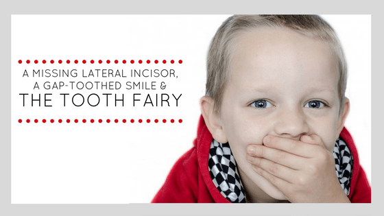 A Missing Lateral Incisor, A Gap-Toothed Smile & The Tooth Fairy