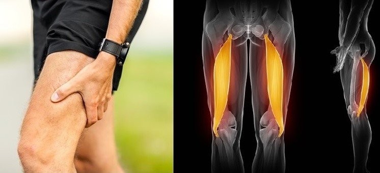 Explorations in Hamstring Injury Concepts - Part III: The Idea of