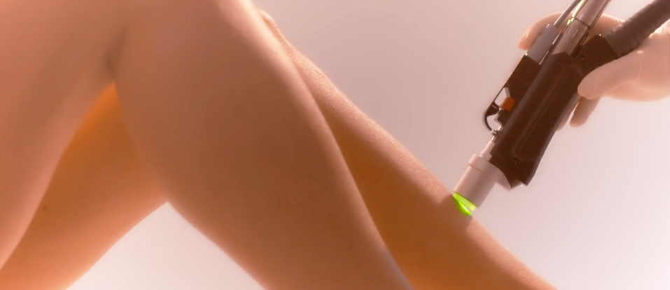 Changing our perceptions of 'Pain-Free' Laser Hair Removal?