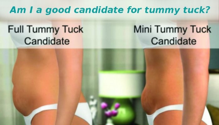 Am I a good candidate for tummy tuck?