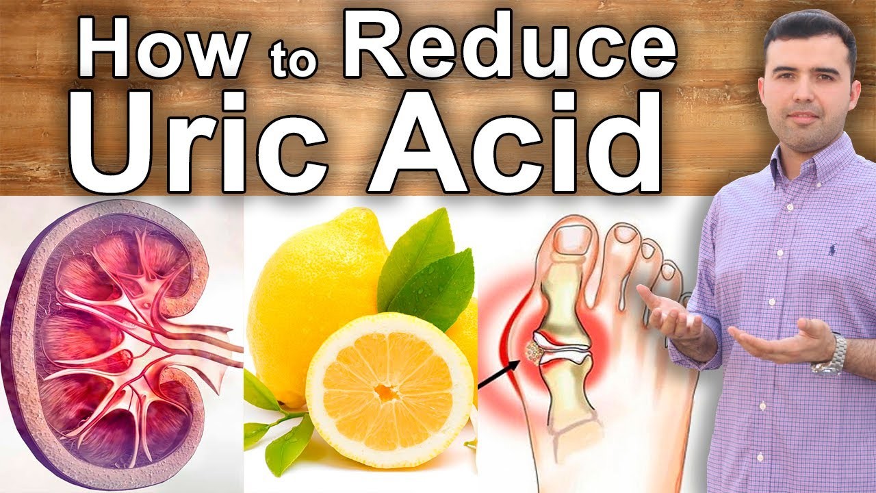 How to Reduce Uric Acid Naturally?