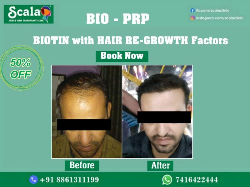 Scala Skin And Hair Transplant Clinic - Hyderabad, Telangana, India |  Professional Profile | LinkedIn