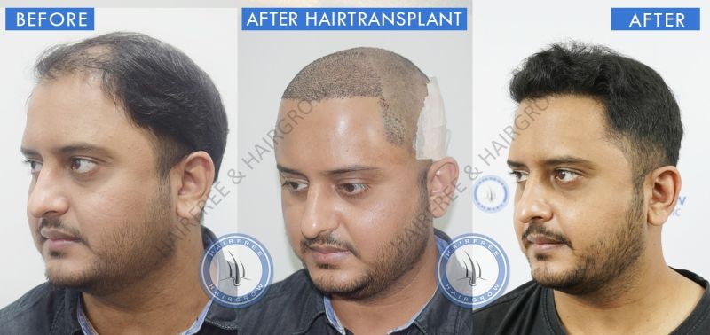 Nipun Kesarkar - Consultant Dermatologist - Urban skin and hair clinic |  LinkedIn