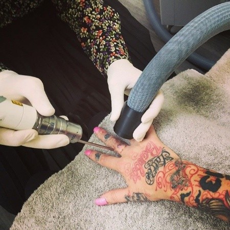 Rachael Arthur - Business Owner - Bearskins Laser Tattoo Removal | LinkedIn