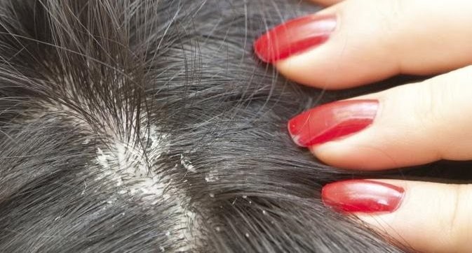 HOMEOPATHY FOR GREY HAIR