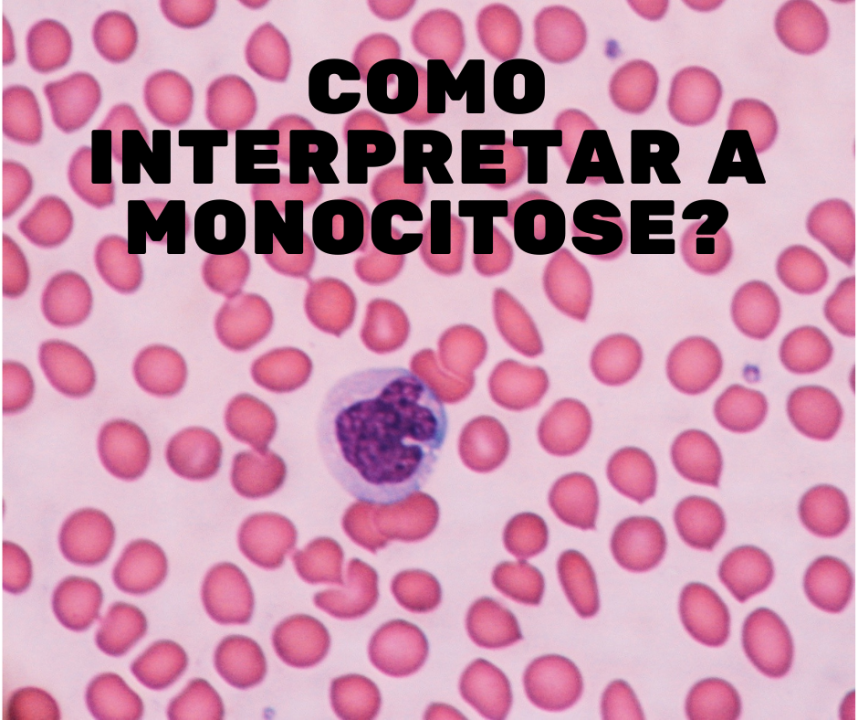 Como interpretar a monocitose?