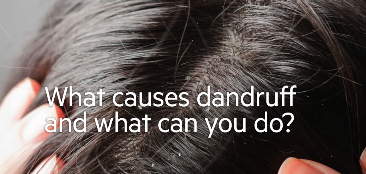 What Causes Hair Dandruff