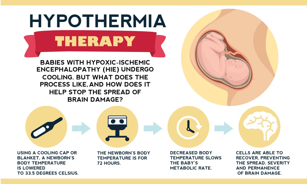 Treatment For HIE Using Hypothermia Cooling