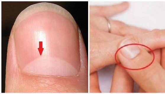 Do You Know What The Half Moon Shape On Your Nails Means The Answer Is More  Important Than You Think!