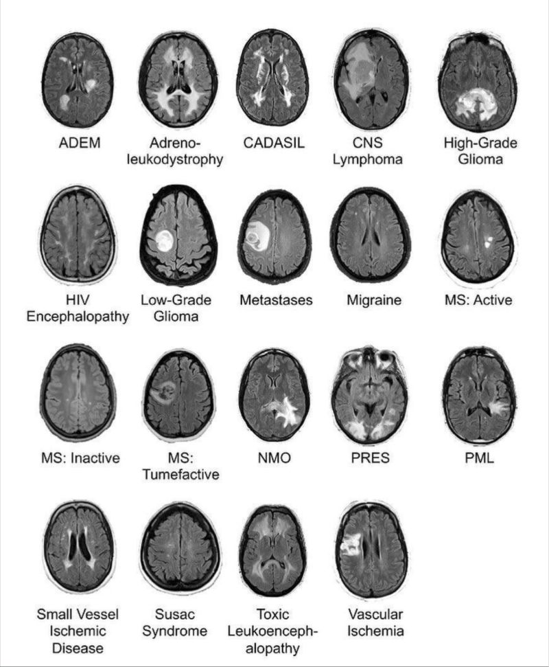 Jean Bruno Banos sur LinkedIn : #mri #irm #neuro #radiologie ...