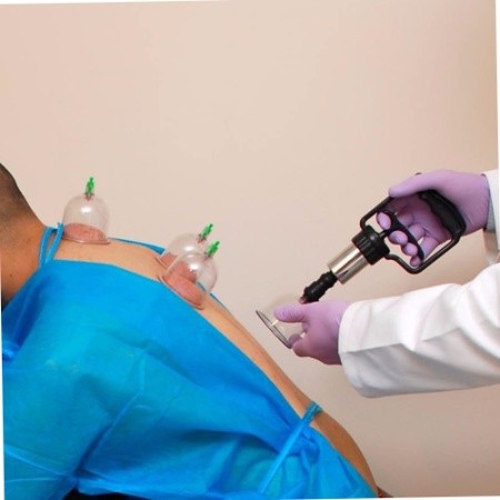 Siddiqui Hijama Cupping and Herbal Clinic - Delhi-NCR - Medical Doctor - Hijama  Cupping Centre | LinkedIn
