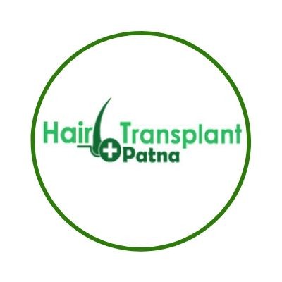Hair Transplant Patna - Hair Specialist - Hair Transplant | LinkedIn