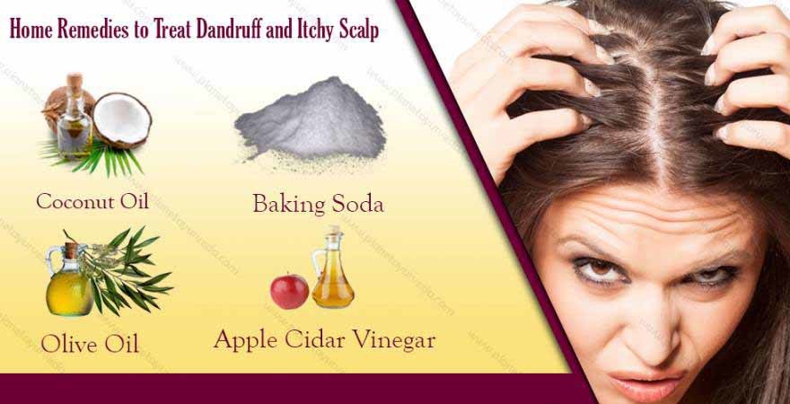 7 Best Home Remedies for Dandruff and Itchy Scalp