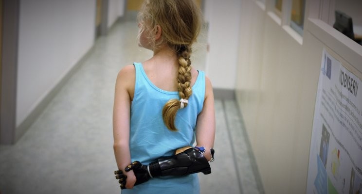 2018 Will Be The Year Bionic Arms Go Mainstream 