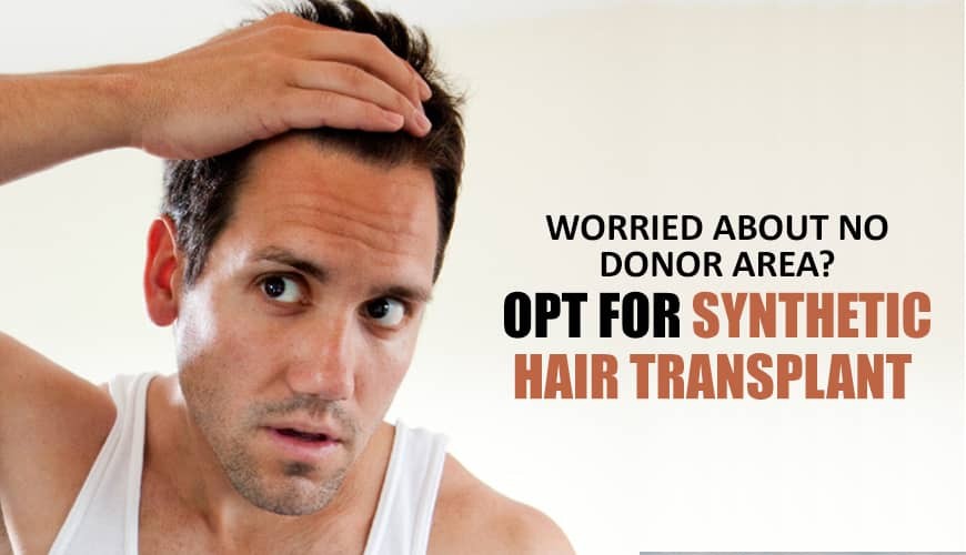 Worried About No Donor Area? Opt For Synthetic Hair Transplant