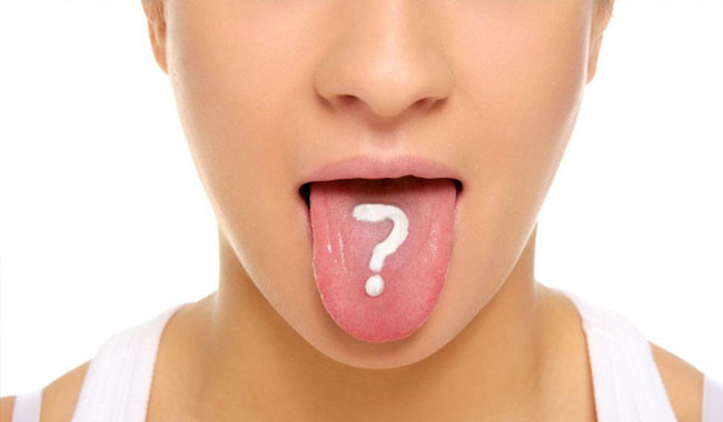 Đau rát lưỡi là bị gì? Cách chữa đau rát lưỡi hiệu quả nhất