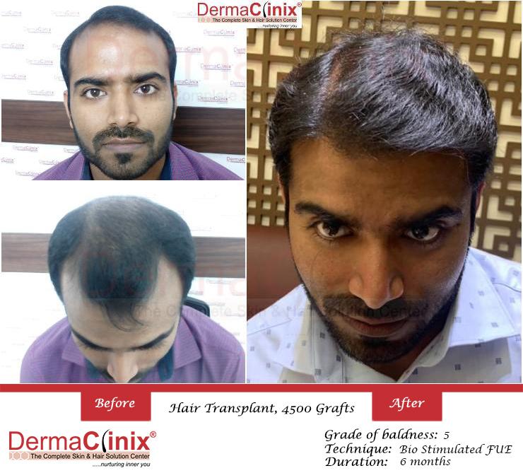 Amit Kumar - Complete Skin & Hair Solution Center - DermaClinix | LinkedIn