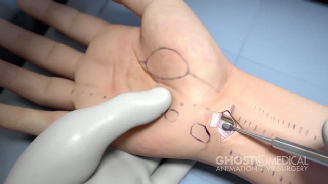 Ghost Productions Medical Animation and Surgical VR | LinkedIn