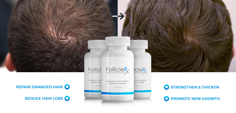 Follicle RX Regen Hair Growth - West Delhi, Delhi, India | Professional Profile | LinkedIn