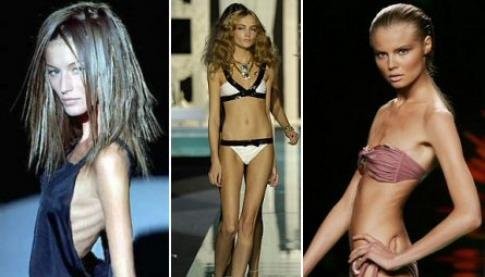 Will Banning Anorexic-looking Models from Fashion Runways Help with Women's Self-Image?