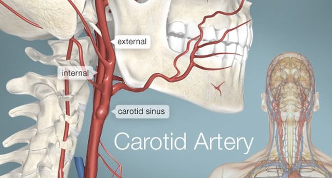 Symptoms and Causes of Carotid Artery Disease - Cardiology Doctor in Houston 