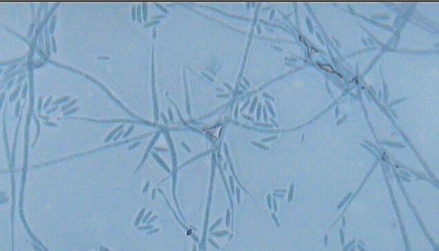 Acrodontium species Fungus