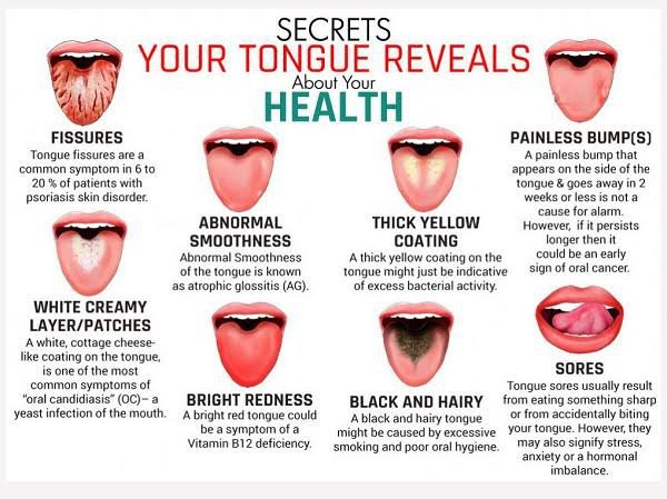 Tongue coating