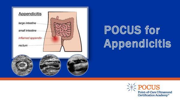 Point of Care Ultrasound Certification Academy on LinkedIn: #pocus # Point of Care Ultrasound Certification Academy on LinkedIn: #pocus #