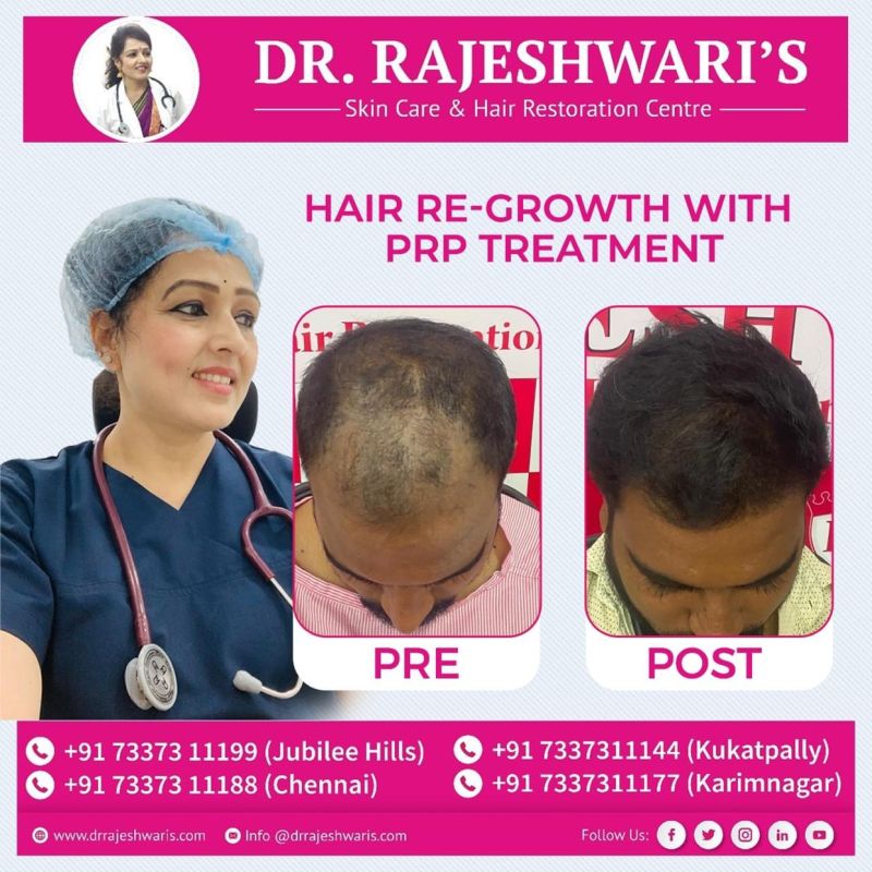 Dr. Rajeshwari Jarupula - DERMATOLOGIST , COSMO AESTHETIC SURGEN AND HAIR  TRANSPLANTATION SURGEN - Skin Care & Hair Restoration Cantre -HYDERABAD |  LinkedIn