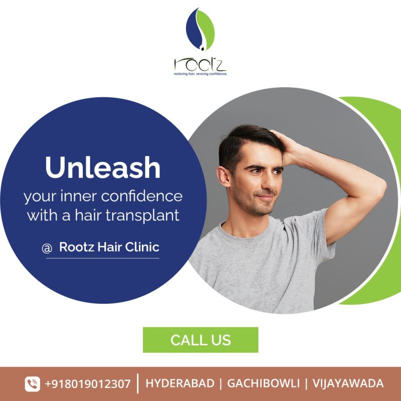ROOTZ HAIR CLINIC - Hyderabad, Telangana, India | Professional Profile |  LinkedIn