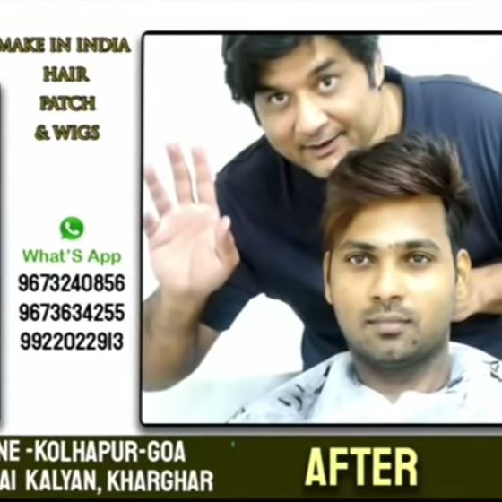 Balram Chhettry - Company Owner - HI-TECH hair replacement | LinkedIn