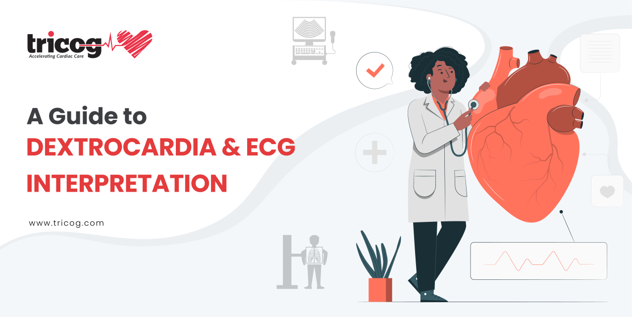 A complete guide about Dextrocardia & its ECG interpretation