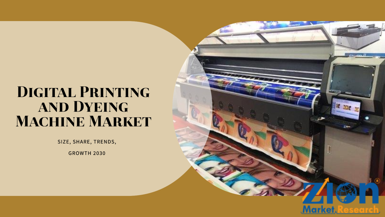 Mercado de máquinas de teñido e impresión digital