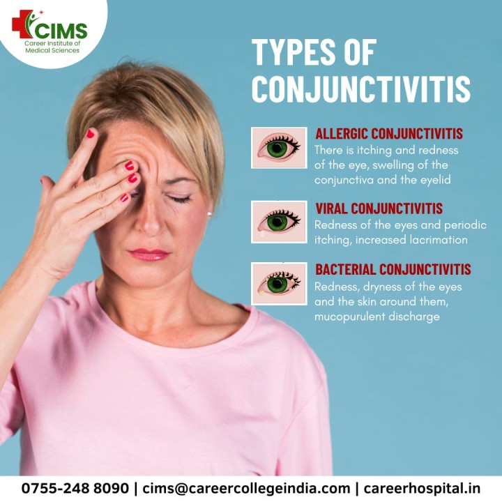 The Three Main Types of Conjunctivitis
