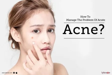 Get rid of acne in just one week 🤯