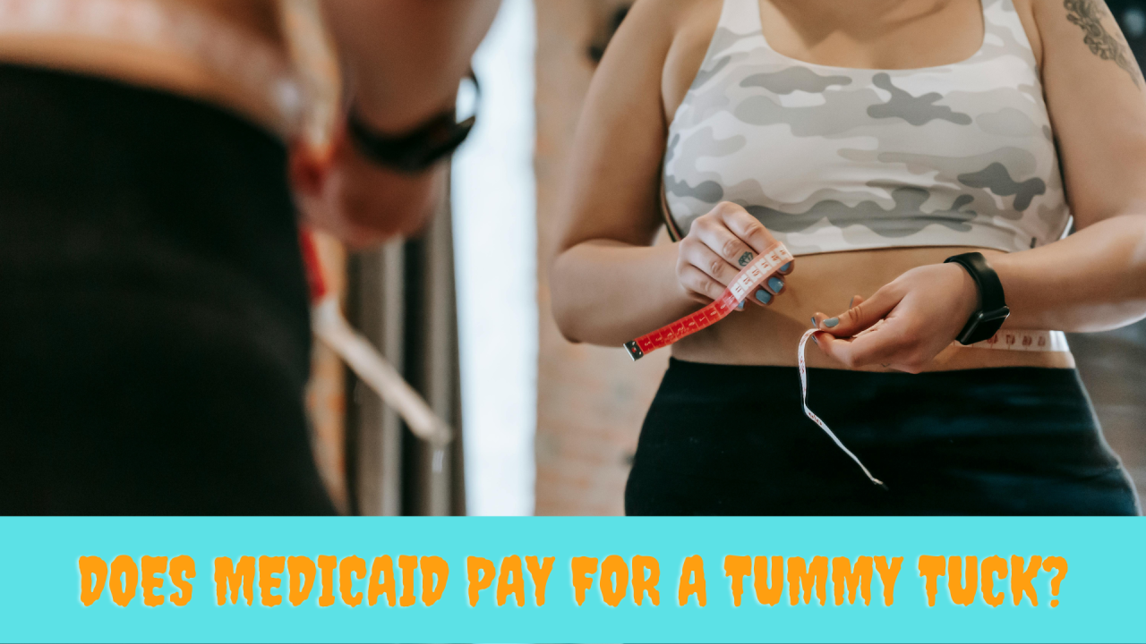 Does Medicaid Pay for a Tummy Tuck