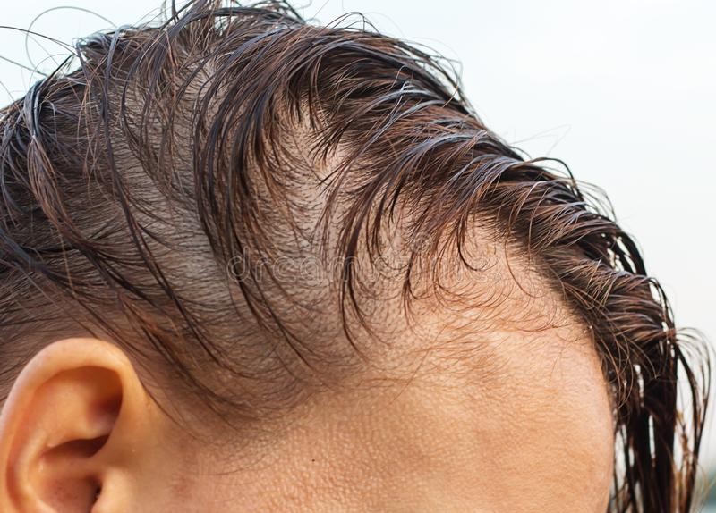Hair Fall Treatment in Dubai & UAE