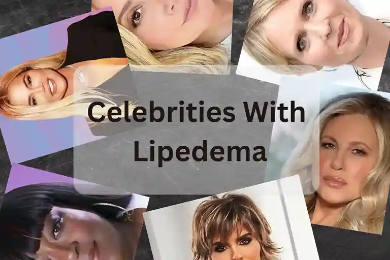 Celebrities with Lipedema