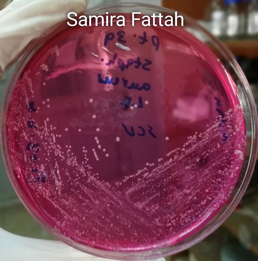 Dr. Samira Fattah on LinkedIn: Staphylococcus aureus small colony ...