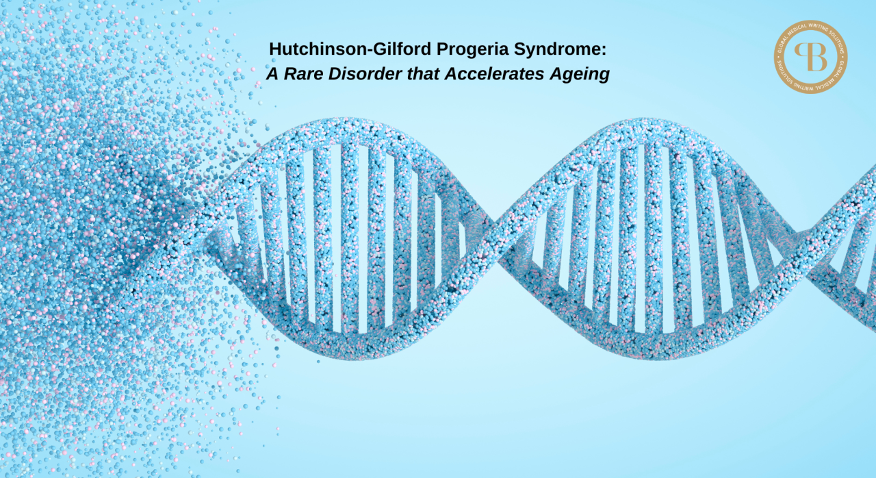 Hutchinson-Gilford Progeria Syndrome: A Rare Disorder that Accelerates Ageing 