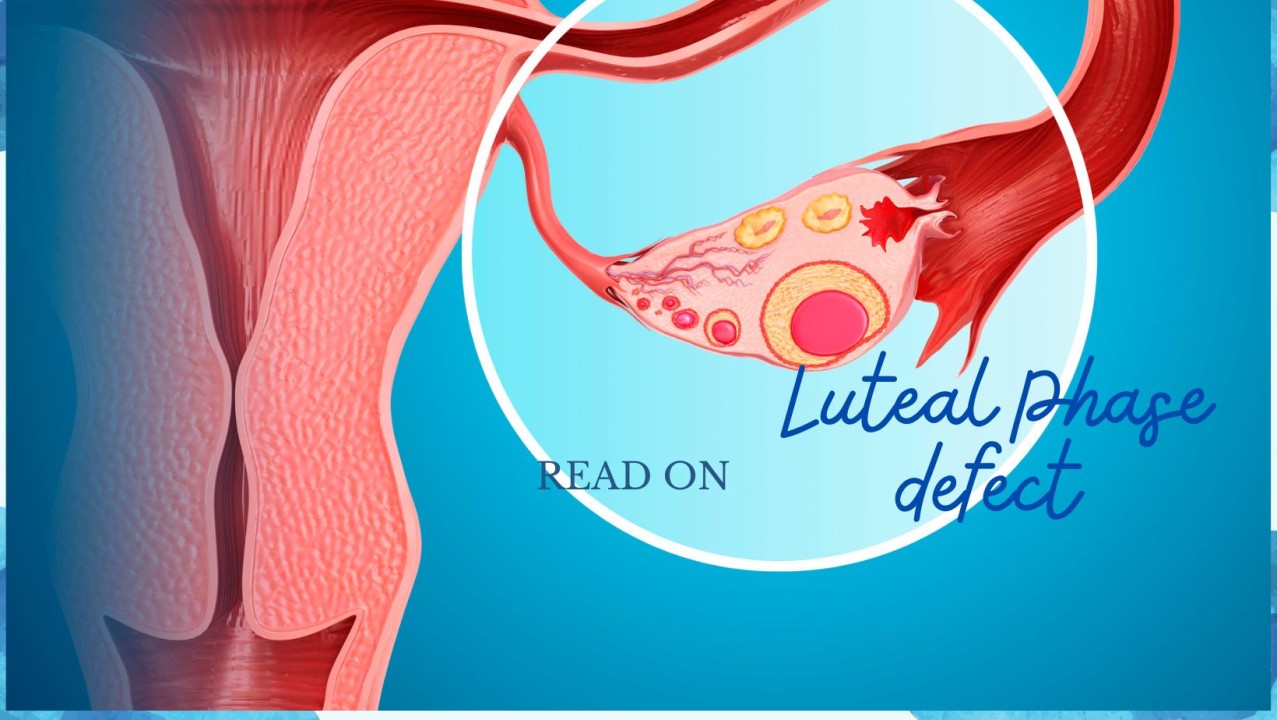 Luteal phase defect : A short summary