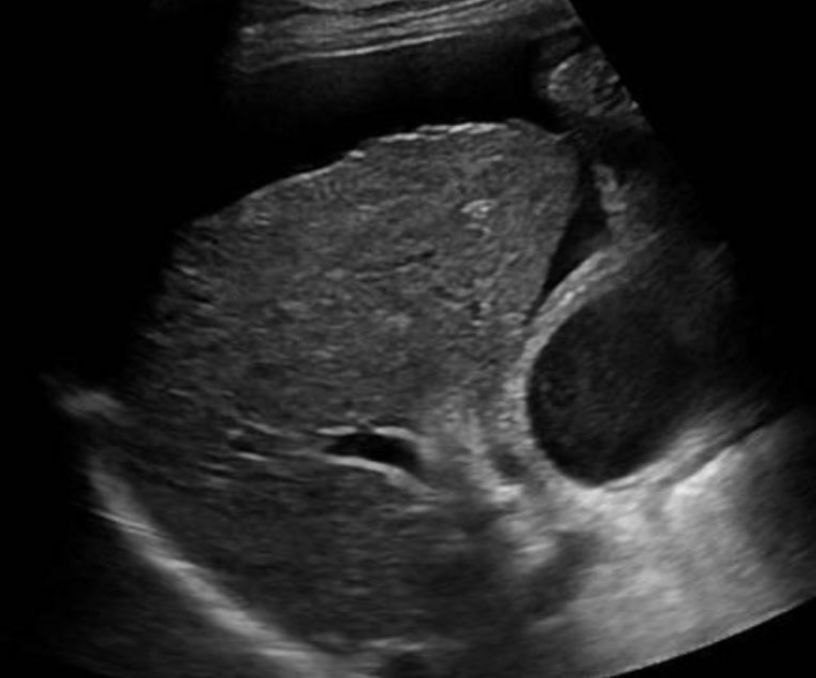 Point of Care Ultrasound Certification Academy on LinkedIn: A 58 year Point of Care Ultrasound Certification Academy on LinkedIn: A 58 year