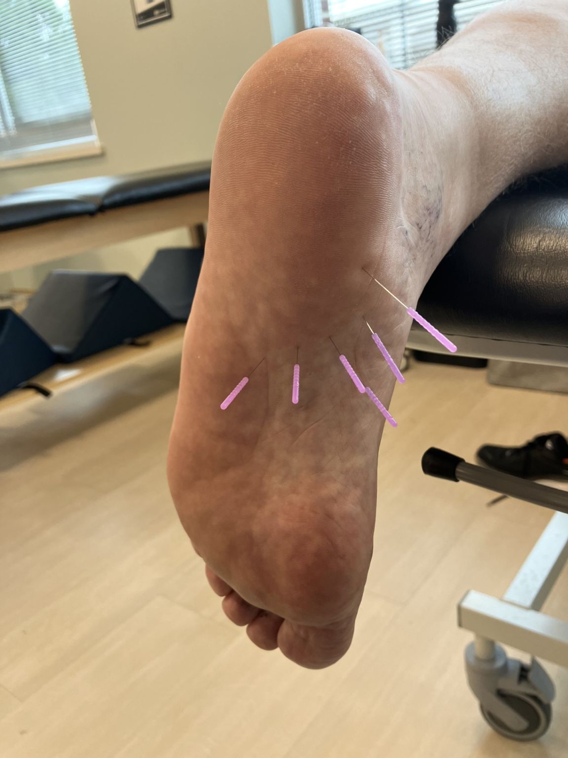 Taylor Main (Porter) Quaglia PT DPT Cert DN on LinkedIn: I LOVE dry Taylor Main (Porter) Quaglia PT DPT Cert DN on LinkedIn: I LOVE dry