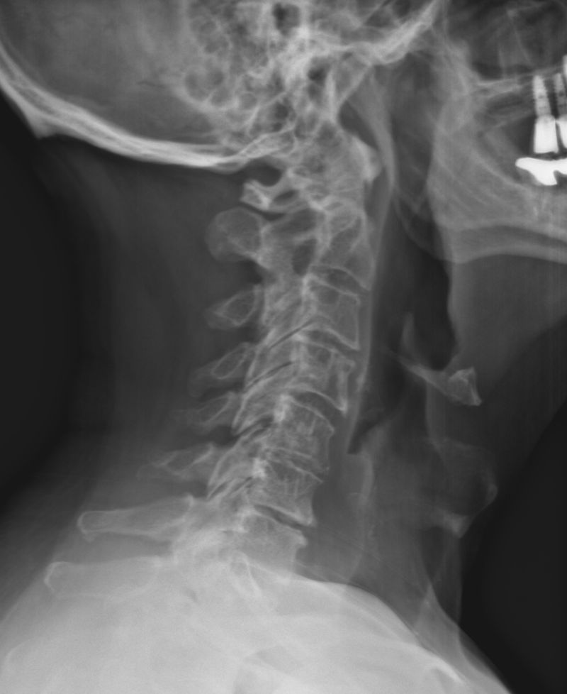 Lance Mabry PT DPT OCS FAAOMPT on LinkedIn: #diagnosticimaging # Lance Mabry PT DPT OCS FAAOMPT on LinkedIn: #diagnosticimaging #