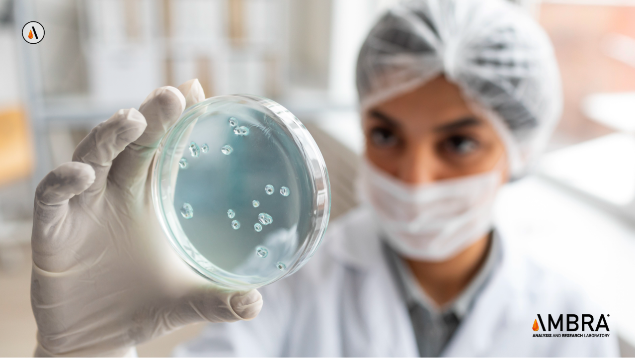 Analisi Microbiologiche breve intro Analisi Microbiologiche breve intro