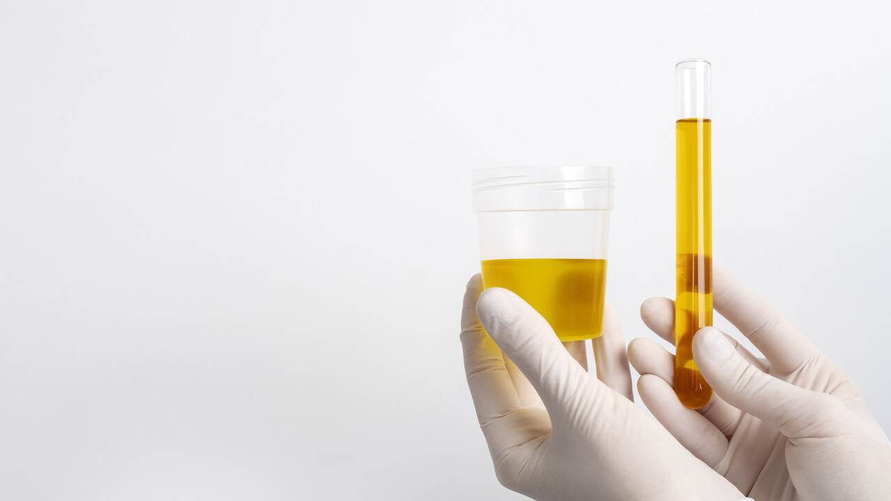 Can Early Pregnancy Affect Urine Color?