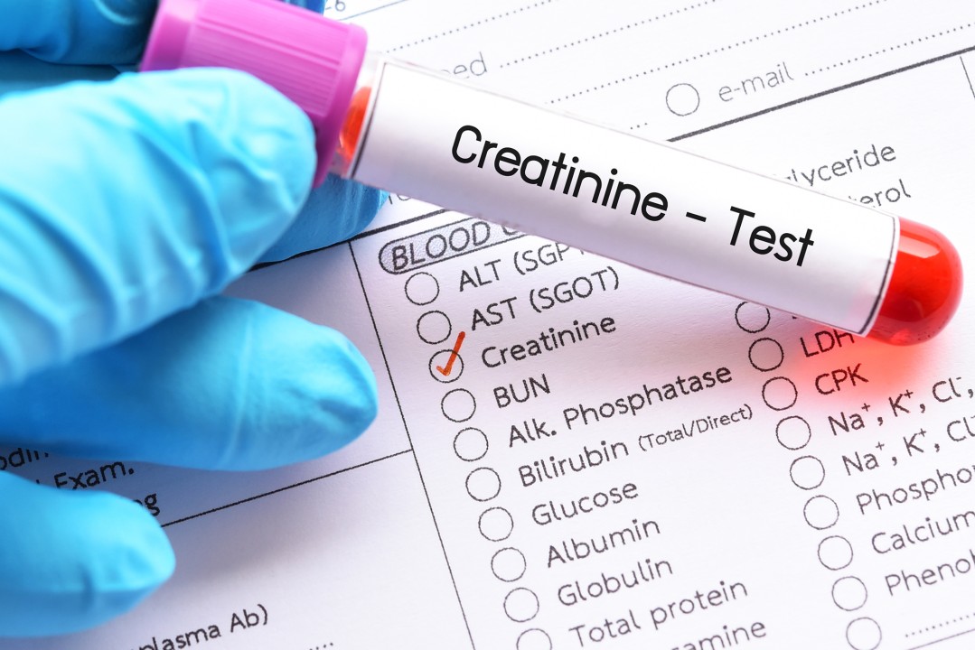 Creatinine Measurement Market Share Analysis and Profit attributable in 2023